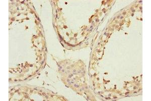 Immunohistochemistry of paraffin-embedded human testis tissue using ABIN7148058 at dilution of 1:100 (CCHCR1 Antikörper  (AA 483-782))