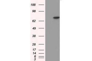 Western Blotting (WB) image for anti-Protein Kinase, CGMP-Dependent, Type I (PRKG1) antibody (ABIN2718495)