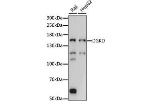Western blot analysis of extracts of various cell lines, using DGKD antibody (ABIN7266748) at 1:1000 dilution. (DGKD Antikörper  (AA 960-1140))