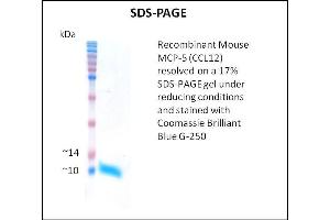 SDS-PAGE (SDS) image for Chemokine (C-C Motif) Ligand 12 (Ccl12) (Active) protein (ABIN5509443) (Ccl12 Protein)
