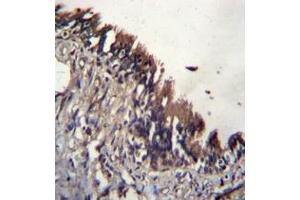 Immunohistochemistry analysis in formalin fixed and paraffin embedded human lung tissue reacted with NUDT9 / NUDT10 (C-term)  Antibody  followed by peroxidase conjugation of the secondary antibody and DAB staining.
