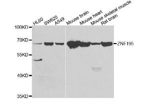 Western blot analysis of extracts of various cell lines, using ZNF195 antibody. (ZNF195 Antikörper  (AA 1-250))