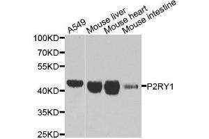 Western blot analysis of extracts of various cell lines, using P2RY1 antibody. (P2RY1 Antikörper  (AA 274-373))