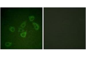 Immunofluorescence analysis of HuvEc cells, using Caspase 6 (Phospho-Ser257) Antibody. (Caspase 6 Antikörper  (pSer257))