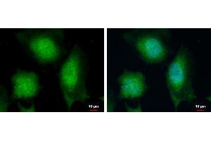 ICC/IF Image Calcipressin 1 antibody detects Calcipressin 1 protein at cytoplasm and nucleus by immunofluorescent analysis. (RCAN1 Antikörper  (C-Term))
