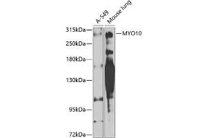 Western blot analysis of extracts of various cell lines, using MYO10 antibody (ABIN6128320, ABIN6144272, ABIN6144275 and ABIN6224500) at 1:1000 dilution. (Myosin X Antikörper  (AA 845-944))