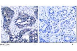 Image no. 1 for anti-Insulin Receptor Substrate 1 (IRS1) (pSer639) antibody (ABIN196981) (IRS1 Antikörper  (pSer639))
