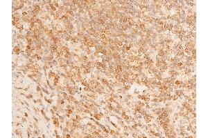 Immunohistochemistry (IHC) image for anti-Tumor Protein P73 (TP73) (pTyr99) antibody (ABIN6256817)