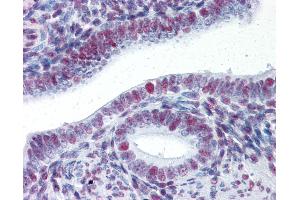 Anti-HSF1 antibody IHC of human uterus. (HSF1 Antikörper)