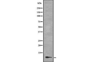 Western blot analysis of MLLT11 using COLO205 whole cell lysates (MLLT11 Antikörper  (N-Term))