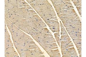ABIN6262822 and ABIN6272335 at 1/100 staining rat muscle tissue by IHC-P.