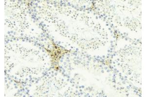 ABIN6274454 at 1/100 staining Mouse testis tissue by IHC-P. (AKAP1 Antikörper  (Internal Region))
