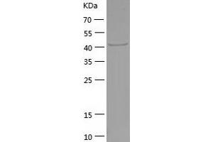 Western Blotting (WB) image for Phosphoglycerate Kinase 1 (PGK1) (AA 1-417) protein (His tag) (ABIN7124416) (PGK1 Protein (AA 1-417) (His tag))