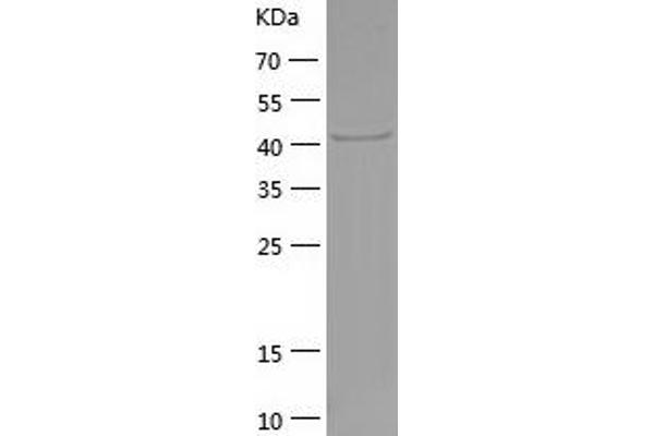 PGK1 Protein (AA 1-417) (His tag)