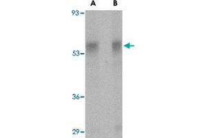 Western blot analysis of PLXDC1 in rat liver tissue lysate with PLXDC1 polyclonal antibody  at (A) 0. (PLXDC1 Antikörper  (Internal Region))