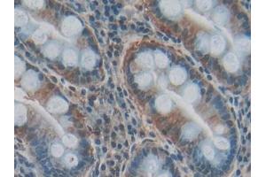 IHC-P analysis of Human Stomach Tissue, with DAB staining. (COL3A1 Antikörper  (AA 1059-1466))