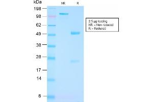SDS-PAGE Analysis Purified FOLH1 Rabbit Recombinant Monoclonal Antibody (FOLH1/3149R). (Rekombinanter PSMA Antikörper  (AA 232-433))