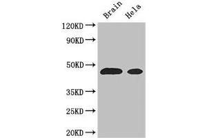 Western Blot Positive WB detected in: Mouse brain tissue, Hela whole cell lysate All lanes: ASS1 antibody at 3 μg/mL Secondary Goat polyclonal to rabbit IgG at 1/50000 dilution Predicted band size: 47 kDa Observed band size: 47 kDa (ASS1 Antikörper  (AA 168-222))