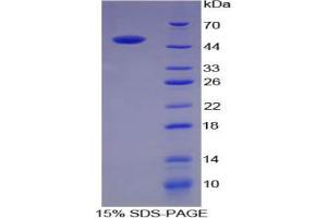 SDS-PAGE analysis of Pig ACE Protein.