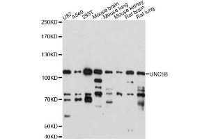 Western blot analysis of extracts of various cell lines, using UNC5B antibody (ABIN6291227) at 1:1000 dilution. (UNC5B Antikörper)