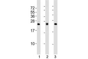 Western blot testing of FGF2 antibody at 1:2000 dilution