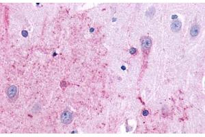 Anti-TACR3 antibody  ABIN1049390 IHC staining of human brain, neurons and glia. (TACR3 Antikörper  (N-Term))