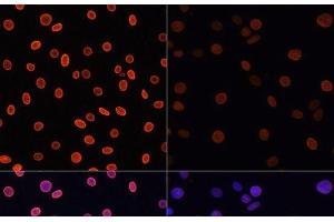 Immunofluorescence analysis of C6 cells using Acetyl-Histone H4-K91 Polyclonal Antibody at dilution of 1:100. (Histone H4 Antikörper  (acLys91))