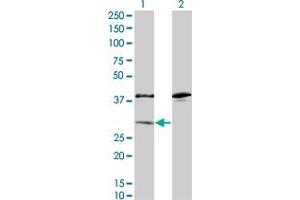 Western Blot analysis of SULT1A1 expression in transfected 293T cell line by SULT1A1 monoclonal antibody (M01A), clone 1F8.