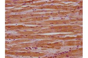 IHC image of ABIN7159742 diluted at 1:400 and staining in paraffin-embedded human heart tissue performed on a Leica BondTM system. (MACF1 Antikörper  (AA 1936-2150))