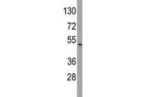 Western Blotting (WB) image for anti-Integrin-Linked Kinase (ILK) (AA 225-253) antibody (ABIN3031385)