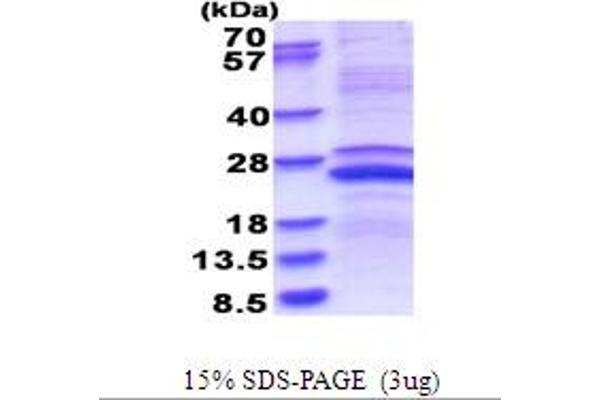 MMP23B Protein (AA 79-254) (His tag)