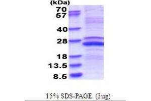 SDS-PAGE (SDS) image for Matrix Metallopeptidase 23B (MMP23B) (AA 79-254) protein (His tag) (ABIN5777663) (MMP23B Protein (AA 79-254) (His tag))