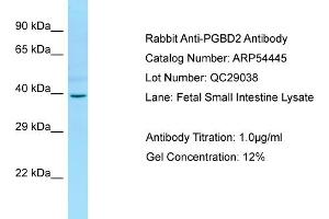 Western Blotting (WB) image for anti-PiggyBac Transposable Element Derived 2 (PGBD2) (Middle Region) antibody (ABIN2785716) (PGBD2 Antikörper  (Middle Region))