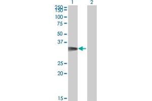 Western Blotting (WB) image for anti-Cyclin-Dependent Kinase 5, Regulatory Subunit 1 (p35) (CDK5R1) (AA 208-307) antibody (ABIN563839)