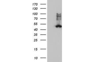 Western Blotting (WB) image for anti-Farnesyl-Diphosphate Farnesyltransferase 1 (FDFT1) antibody (ABIN1498243) (FDFT1 Antikörper)