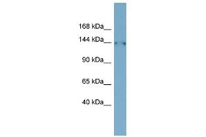 FAM135B antibody used at 1 ug/ml to detect target protein. (FAM135B Antikörper  (Middle Region))