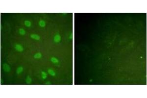 Immunofluorescence analysis of HeLa cells, using Ku80 (Phospho-Thr714) Antibody. (XRCC5 Antikörper  (pThr714))