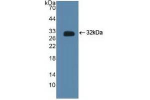 Western blot analysis of recombinant Human CTBP2. (CTBP2 Antikörper  (C-Term))