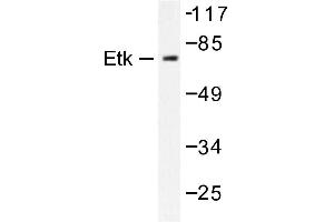 Image no. 1 for anti-BMX Non-Receptor Tyrosine Kinase (BMX) antibody (ABIN272021) (BMX Antikörper)