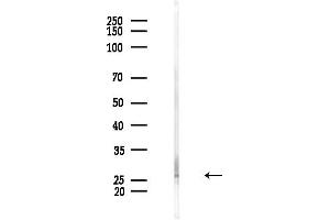 anti-Dynactin 6 (DCTN6) (Internal Region) antibody