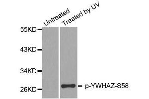 Western blot analysis of extracts from HeLa cells, using Phospho-YWHAZ-S58 antibody (ABIN2987575). (14-3-3 zeta Antikörper  (pSer58))