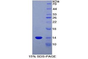 SDS-PAGE (SDS) image for Chemokine (C-C Motif) Ligand 6 (CCL6) (AA 21-115) protein (His tag) (ABIN1880072)