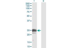 Western Blot analysis of NBL1 expression in transfected 293T cell line by NBL1 monoclonal antibody (M02), clone 1G5. (NBL1 Antikörper  (AA 21-130))
