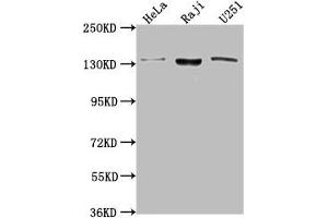 Western Blot Positive WB detected in: Hela whole cell lysate, Raji whole cell lysate, U251 whole cell lysate All lanes: LARS antibody at 1:2000 Secondary Goat polyclonal to rabbit IgG at 1/50000 dilution Predicted band size: 135, 129, 56 kDa Observed band size: 135 kDa (LARS Antikörper  (AA 614-892))