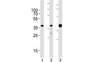 Western blot analysis of lysate from 1) MCF-7, 2) HeLa cell line and 3) human skeletal muscle tissue lysate using ALDOA antibody at 1:1000. (ALDOA Antikörper  (AA 303-331))