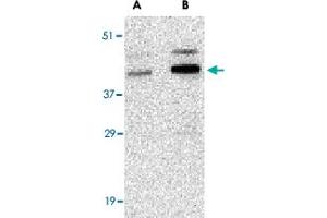 Western blot analysis of CCNO in human bladder tissue lysate with CCNO polyclonal antibody  at (A) 1 and (B) 2 ug/mL .