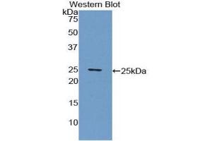Western Blotting (WB) image for anti-C-Reactive Protein (CRP) (AA 20-222) antibody (ABIN1077881) (CRP Antikörper  (AA 20-222))
