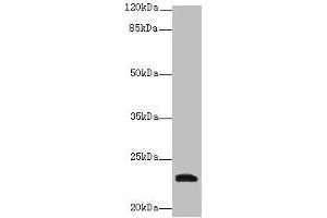 Western blot All lanes: YKT6 antibody at 12 μg/mL + A549 whole cell lysate Secondary Goat polyclonal to rabbit IgG at 1/10000 dilution Predicted band size: 23, 19 kDa Observed band size: 23 kDa