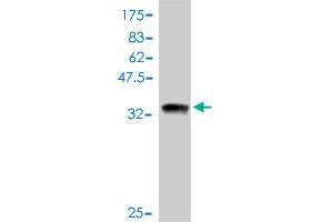 Western Blot detection against Immunogen (39. (PRKACA Antikörper  (AA 1-120))