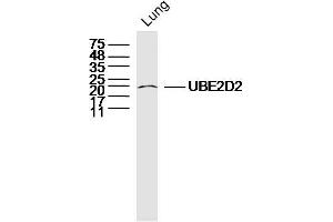 Mouse lung lysates probed with UBE2D2 Polyclonal Antibody, Unconjugated  at 1:300 dilution and 4˚C overnight incubation.